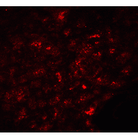 SLC30A8 / ZNT8 Antibody - Immunofluorescence of SLC30A8 in human pancreas tissue with SLC30A8 Antibody at 20 µg/mL.