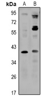 SLC30A8 / ZNT8 Antibody - Western blot analysis of ZNT8 expression in H9C2 (A), K562 (B) whole cell lysates.