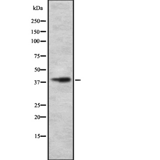 SLC30A8 / ZNT8 Antibody - Western blot analysis SLC30A8 using MCF-7 whole cells lysates
