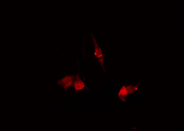 SLC30A8 / ZNT8 Antibody - Staining HeLa cells by IF/ICC. The samples were fixed with PFA and permeabilized in 0.1% Triton X-100, then blocked in 10% serum for 45 min at 25°C. The primary antibody was diluted at 1:200 and incubated with the sample for 1 hour at 37°C. An Alexa Fluor 594 conjugated goat anti-rabbit IgG (H+L) Ab, diluted at 1/600, was used as the secondary antibody.