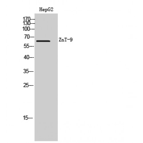 SLC30A9 / ZNT9 Antibody - Western blot of ZnT-9 antibody