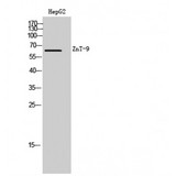 SLC30A9 / ZNT9 Antibody - Western blot of ZnT-9 antibody