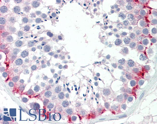 SLC30A9 / ZNT9 Antibody - Anti-SLC30A9 / ZNT9 antibody IHC staining of human testis. Immunohistochemistry of formalin-fixed, paraffin-embedded tissue after heat-induced antigen retrieval. Antibody concentration 10 ug/ml.  This image was taken for the unconjugated form of this product. Other forms have not been tested.