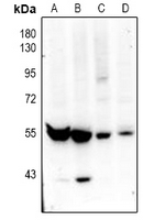 SLC30A9 / ZNT9 Antibody - Western blot analysis of ZNT9 expression in CT26 (A), C6 (B), HEK293T (C), HepG2 (D) whole cell lysates.