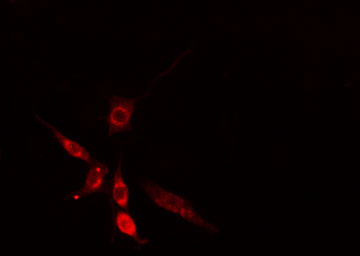 SLC30A9 / ZNT9 Antibody - Staining HepG2 cells by IF/ICC. The samples were fixed with PFA and permeabilized in 0.1% Triton X-100, then blocked in 10% serum for 45 min at 25°C. The primary antibody was diluted at 1:200 and incubated with the sample for 1 hour at 37°C. An Alexa Fluor 594 conjugated goat anti-rabbit IgG (H+L) antibody, diluted at 1/600, was used as secondary antibody.