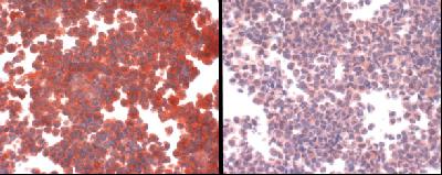 SLC31A1 / CTR1 Antibody - The photo on the left is antibody staining of hCTR1 overexpressing cell line. The photo on the right is antibody plus peptide competition staining.  This image was taken for the unconjugated form of this product. Other forms have not been tested.