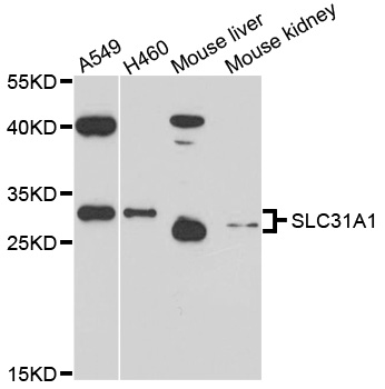 SLC31A1 / CTR1 Antibody - Western blot analysis of extracts of various cell lines, using SLC31A1 antibody at 1:1000 dilution. The secondary antibody used was an HRP Goat Anti-Rabbit IgG (H+L) at 1:10000 dilution. Lysates were loaded 25ug per lane and 3% nonfat dry milk in TBST was used for blocking. An ECL Kit was used for detection and the exposure time was 90s.