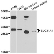 SLC31A1 / CTR1 Antibody - Western blot analysis of extracts of various cell lines, using SLC31A1 antibody at 1:1000 dilution. The secondary antibody used was an HRP Goat Anti-Rabbit IgG (H+L) at 1:10000 dilution. Lysates were loaded 25ug per lane and 3% nonfat dry milk in TBST was used for blocking. An ECL Kit was used for detection and the exposure time was 90s.