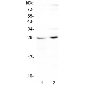 SLC31A1 / CTR1 Antibody - Western blot testing of human 1) HepG2 and 2) PANC-1 cell lysate with CTR1 antibody at 0.5ug/ml. Expected molecular weight ~25 kDa (unmodified), 35-37 kDa (glycosylated).