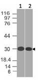 SLC31A1 / CTR1 Antibody - Fig-1: Western blot analysis of SLC31A1. Anti-SLC31A1 antibody was tested at 1 µg/ml on (1) T98G and (2) THP1 lysates.