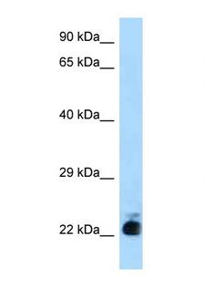 SLC31A1 / CTR1 Antibody - SLC31A1 / CTR1 antibody Western blot of Mouse Liver lysate. Antibody concentration 1 ug/ml.  This image was taken for the unconjugated form of this product. Other forms have not been tested.