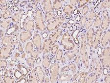 SLC31A2 Antibody - Immunochemical staining of human SLC31A2 in human kidney with rabbit polyclonal antibody at 1:100 dilution, formalin-fixed paraffin embedded sections.