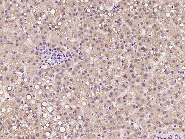 SLC31A2 Antibody - Immunochemical staining of human SLC31A2 in human liver with rabbit polyclonal antibody at 1:100 dilution, formalin-fixed paraffin embedded sections.