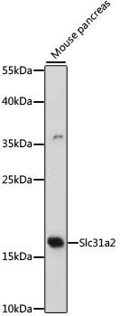 SLC31A2 Antibody - Western blot analysis of extracts of mouse pancreas using Slc31a2 Polyclonal Antibody at dilution of 1:500.