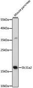 SLC31A2 Antibody - Western blot analysis of extracts of mouse pancreas using Slc31a2 Polyclonal Antibody at dilution of 1:500.