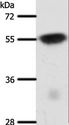SLC32A1 / VGAT Antibody - Western blot analysis of Mouse brain tissue, using SLC32A1 Polyclonal Antibody at dilution of 1:950.