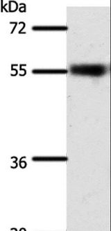 SLC32A1 / VGAT Antibody - Western blot analysis of Mouse eye tissue, using SLC32A1 Polyclonal Antibody at dilution of 1:500.