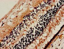 SLC32A1 / VGAT Antibody - Immunohistochemistry image of paraffin-embedded human eye tissue at a dilution of 1:100