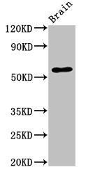 SLC32A1 / VGAT Antibody - Positive Western Blot detected in Mouse brain tissue. All lanes: SLC32A1 antibody at 3.4 µg/ml Secondary Goat polyclonal to rabbit IgG at 1/50000 dilution. Predicted band size: 58 KDa. Observed band size: 58 KDa
