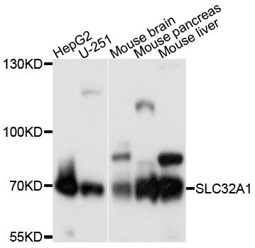 SLC32A1 / VGAT Antibody - Western blot analysis of extracts of various cell lines, using SLC32A1 antibody at 1:1000 dilution. The secondary antibody used was an HRP Goat Anti-Rabbit IgG (H+L) at 1:10000 dilution. Lysates were loaded 25ug per lane and 3% nonfat dry milk in TBST was used for blocking. An ECL Kit was used for detection and the exposure time was 10s.