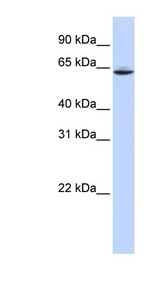 SLC33A1 Antibody - SLC33A1 antibody western blot of human placenta lysate.  This image was taken for the unconjugated form of this product. Other forms have not been tested.