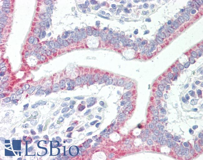 SLC33A1 Antibody - Human Small Intestine: Formalin-Fixed, Paraffin-Embedded (FFPE).  This image was taken for the unconjugated form of this product. Other forms have not been tested.