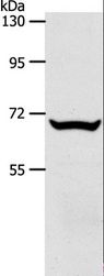 SLC33A1 Antibody - Western blot analysis of Mouse liver tissue, using SLC33A1 Polyclonal Antibody at dilution of 1:700.