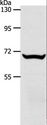 SLC33A1 Antibody - Western blot analysis of Mouse liver tissue, using SLC33A1 Polyclonal Antibody at dilution of 1:700.