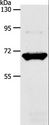 SLC33A1 Antibody - Western blot analysis of Mouse liver tissue, using SLC33A1 Polyclonal Antibody at dilution of 1:1100.