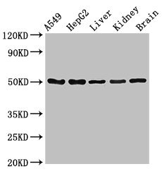 SLC33A1 Antibody - Western Blot Positive WB detected in: A549 whole cell lysate, HepG2 whole cell lysate, Mouse liver tissue, Mouse kidney tissue, Mouse brain tissue All lanes: SLC33A1 antibody at 2.5µg/ml Secondary Goat polyclonal to rabbit IgG at 1/50000 dilution Predicted band size: 61 kDa Observed band size: 50 kDa