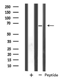SLC33A1 Antibody - Western blot analysis of SLC33A1 expression in human Placenta lysate