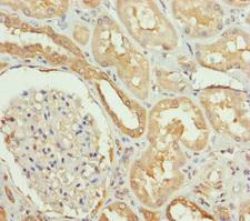 SLC34A1 / NPT2 Antibody - Immunohistochemistry of paraffin-embedded human kidney tissue at dilution of 1:100