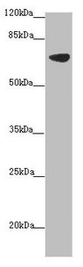 SLC34A1 / NPT2 Antibody - Western blot All Lanes: SLC34A1 antibody at 2.34 ug/ml+ Mouse brain tissue Secondary Goat polyclonal to rabbit IgG at 1/10000 dilution Predicted band size: 69,37 kDa Observed band size: 69 kDa