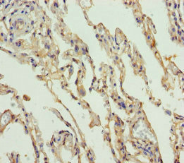 SLC34A1 / NPT2 Antibody - Immunohistochemistry of paraffin-embedded human lung tissue at dilution of 1:100