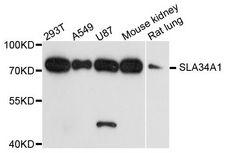 SLC34A1 / NPT2 Antibody - Western blot analysis of extracts of various cell lines, using SLC34A1 antibody at 1:1000 dilution. The secondary antibody used was an HRP Goat Anti-Rabbit IgG (H+L) at 1:10000 dilution. Lysates were loaded 25ug per lane and 3% nonfat dry milk in TBST was used for blocking. An ECL Kit was used for detection and the exposure time was 90s.