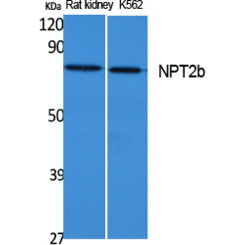 SLC34A2 / NaPi-2b Antibody - Western blot of NPT2b antibody