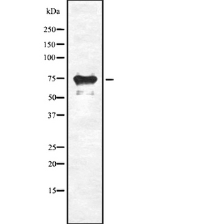 SLC34A2 / NaPi-2b Antibody - Western blot analysis of SLC34A2 expression in HEK293 cells. The lane on the left is treated with the antigen-specific peptide.