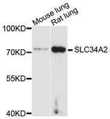 SLC34A2 / NaPi-2b Antibody - Western blot analysis of extracts of various cell lines.