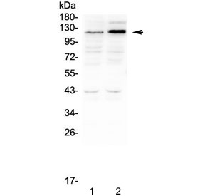 SLC34A2 / NaPi-2b Antibody - Western blot testing of human 1) HEK293 and 2) K562 cell lysate with SLC34A2 antibody at 0.5ug/ml. Predicted molecular weight ~76 kDa, but may be observed at up to ~130 kDa due to glycosylation.