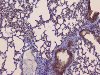 SLC34A2 / NaPi-2b Antibody - IHC staining of FFPE mouse lung with SLC34A2 antibody. HIER: boil tissue sections in pH6, 10mM citrate buffer, for 10-20 min and allow to cool before testing.