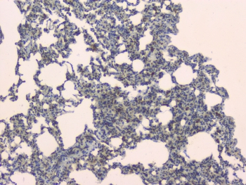 SLC34A2 / NaPi-2b Antibody - IHC staining of FFPE rat lung with SLC34A2 antibody. HIER: boil tissue sections in pH6, 10mM citrate buffer, for 10-20 min and allow to cool before testing.