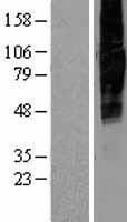 SLC34A2 / NaPi-2b Protein - Western validation with an anti-DDK antibody * L: Control HEK293 lysate R: Over-expression lysate