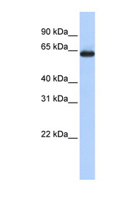 SLC34A3 / NaPi-2c Antibody - SLC34A3 antibody Western blot of Fetal Lung lysate. This image was taken for the unconjugated form of this product. Other forms have not been tested.