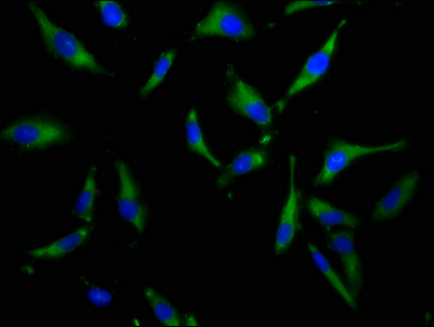 SLC34A3 / NaPi-2c Antibody - Immunofluorescence staining of Hela cells at a dilution of 1:100, counter-stained with DAPI. The cells were fixed in 4% formaldehyde, permeabilized using 0.2% Triton X-100 and blocked in 10% normal Goat Serum. The cells were then incubated with the antibody overnight at 4 °C.The secondary antibody was Alexa Fluor 488-congugated AffiniPure Goat Anti-Rabbit IgG (H+L) .