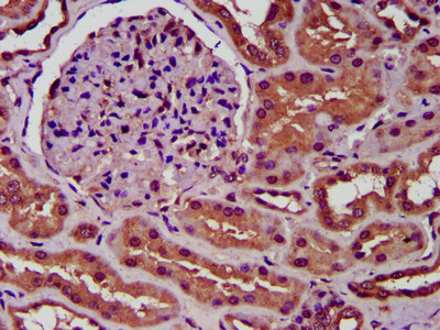 SLC34A3 / NaPi-2c Antibody - Immunohistochemistry image at a dilution of 1:300 and staining in paraffin-embedded human kidney tissue performed on a Leica BondTM system. After dewaxing and hydration, antigen retrieval was mediated by high pressure in a citrate buffer (pH 6.0) . Section was blocked with 10% normal goat serum 30min at RT. Then primary antibody (1% BSA) was incubated at 4 °C overnight. The primary is detected by a biotinylated secondary antibody and visualized using an HRP conjugated SP system.