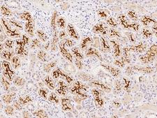 SLC34A3 / NaPi-2c Antibody - Immunochemical staining of human SLC34A3 in human kidney with rabbit polyclonal antibody at 1:500 dilution, formalin-fixed paraffin embedded sections.