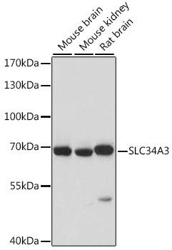 SLC34A3 / NaPi-2c Antibody - Western blot analysis of extracts of various cell lines using SLC34A3 Polyclonal Antibody at dilution of 1:1000.
