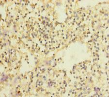 SLC35A1 Antibody - Immunohistochemistry of paraffin-embedded human spleen tissue at dilution of 1:100