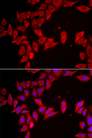 SLC35A2 / UGT Antibody - Immunofluorescence analysis of HeLa cells.