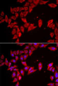SLC35A2 / UGT Antibody - Immunofluorescence analysis of HeLa cells.